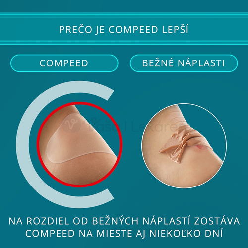 Compeed Gélová náplasť na pľuzgiere na nohách (stredná)