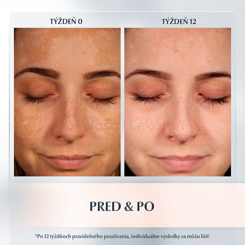 Eucerin Anti-Pigment Nočný krém