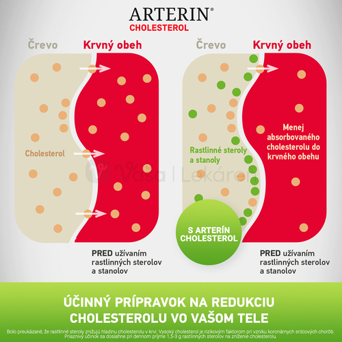 Arterin Cholesterol