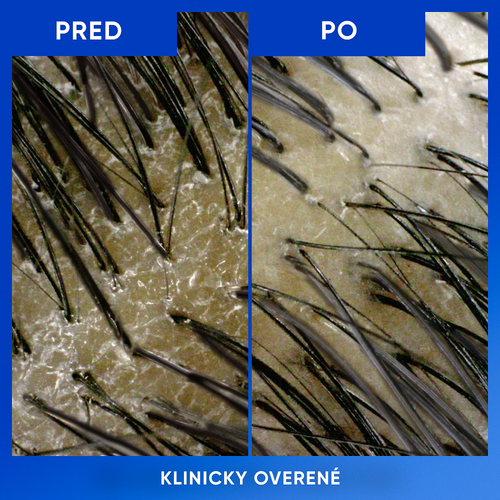 Head & Shoulders Clarify & Shine Šampón proti lupinám