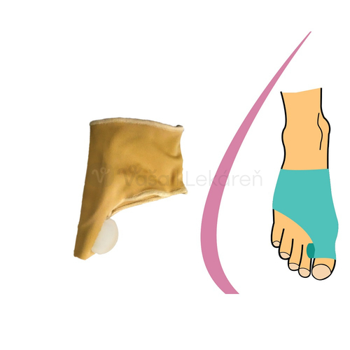 HealMed Bandáž Hallux valgus s medziprstovým korektorom, uni
