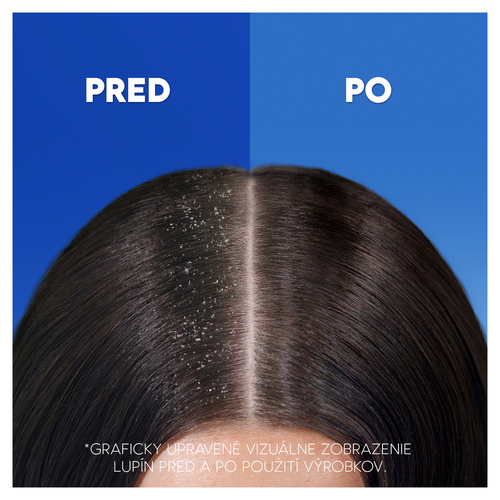 Head & Shoulders Anti-Hair Fall Šampón proti lupinám