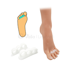 HealMed Gélový separátor prstov, uni