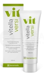 Vitella Versi (na Pityriasis versicolor)