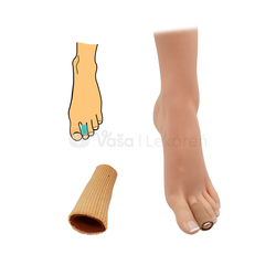 HealMed Návlek Tubus na prsty, 15 cm, priemer 20 mm