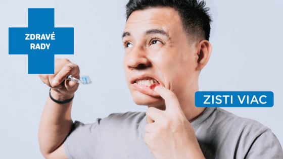 Liečba zápalu ďasien – čo pomáha?