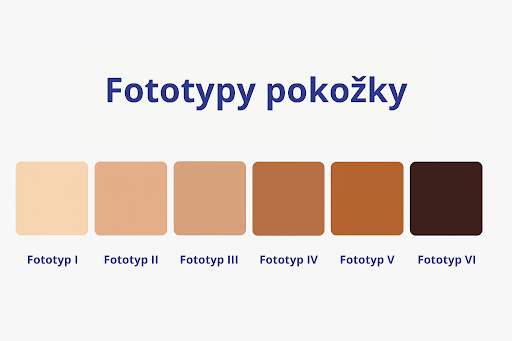Fitzpatrickova stupnica fotoyptov pokožky.