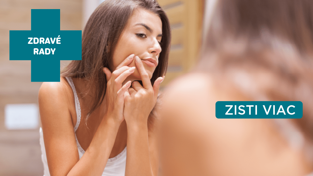 Ako sa zbaviť akné na tvári – tipy a rady