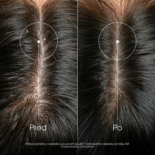 Klorane Šampón proti lupinám s galangalom