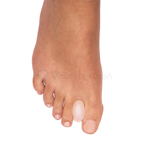 Protetika Silikónový separátor prstov, veľ. S (35 - 38)