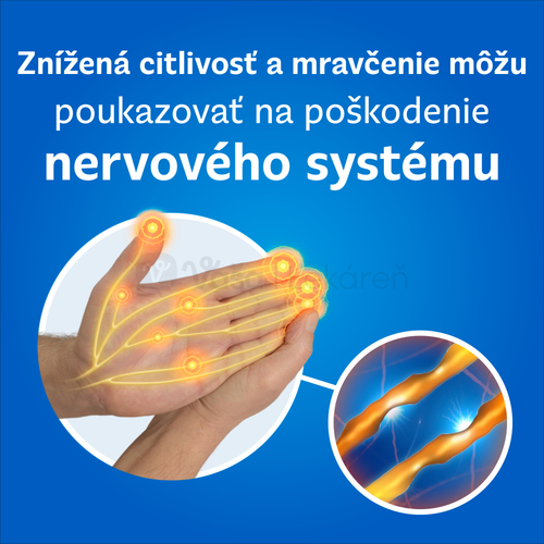 Neurobion 100 mg/50 mg/1 mg