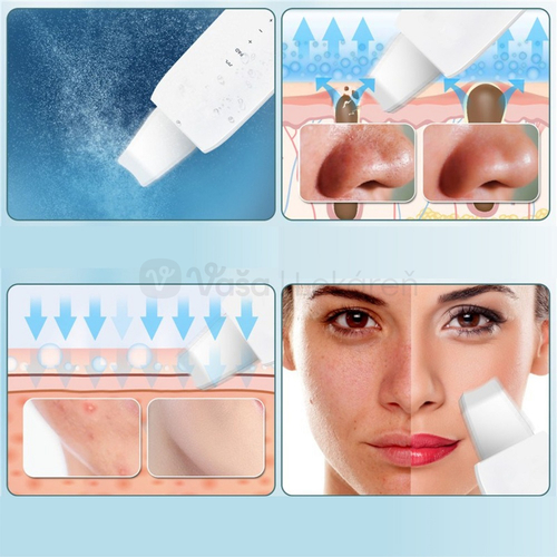 Ultrazvuková špachtľa